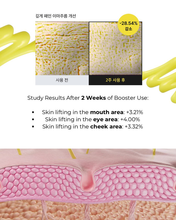 رتینال سلیمکس