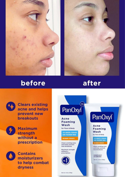 شوینده جوش پانوکسیل