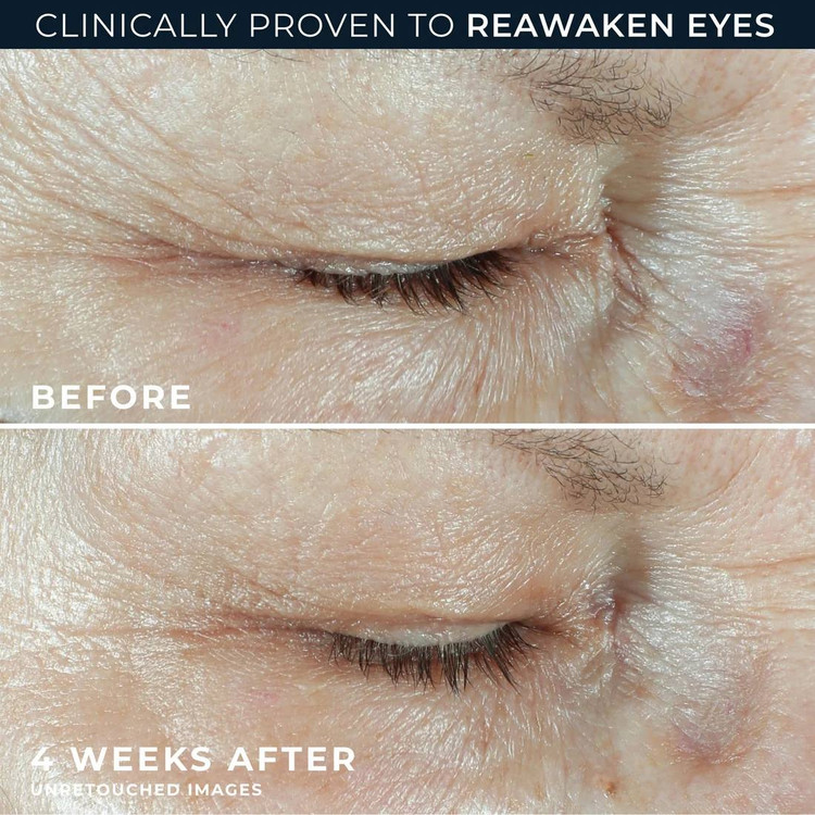 کرم دور چشم آبرسان و پُرکننده خطوط رو سی (RoC) مدل Hydration+ Replumping حجم ۱۵ میلیلیتر